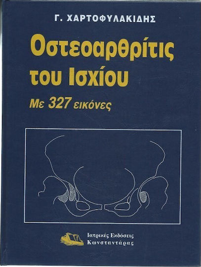 Οστεοαρθρίτις του ισχίου