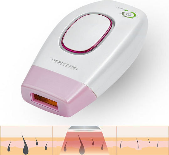 ProfiCare PC-IPL 3024 IPL Αποτριχωτική Μηχανή για Πρόσωπο, Σώμα & Μπικίνι 229-0004