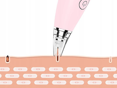 inFace MS-7000 Συσκευή Καθαρισμού Προσώπου από Μαύρα Στίγματα