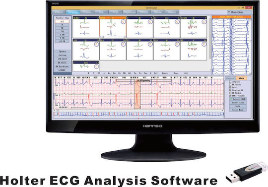 Borsam ECG Patch Holter Ρυθμού 3 Απαγωγών