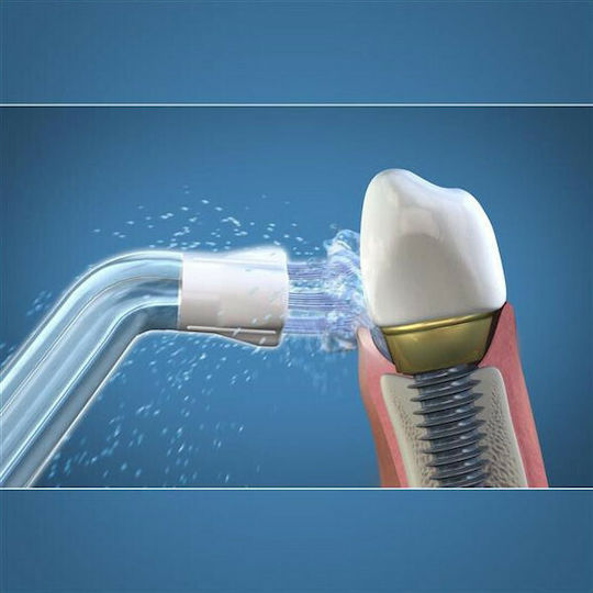 Waterpik Plaque Seeker PS-100E Ανταλλακτικά για 2τμχ