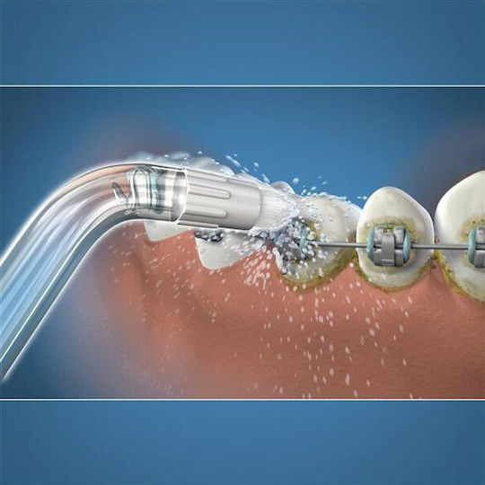 Waterpik Orthodontic Tip Capete de schimb pentru Flosser OD-100E 2buc