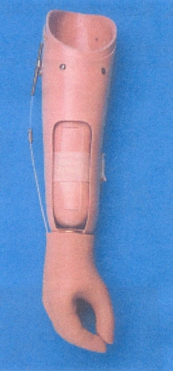 Kifidis Orthopedics Proteză Antebraț Sau Luxație De Încheietură Ajutor Mecanic De Mers Bej 0058.2.2.2