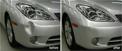 Diy Dent and Ding Repair Kit Επιδιόρθωσης για Βαθουλώματα Αυτοκινήτου