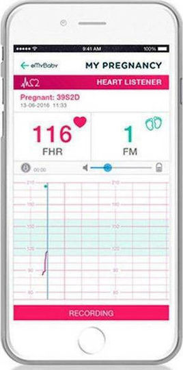 Miniland Sweet Beat Gynecological Doppler