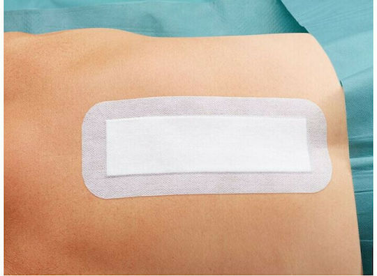 Hartmann Cosmopor E Sterilized Plasters 7.2x5cm 50pcs