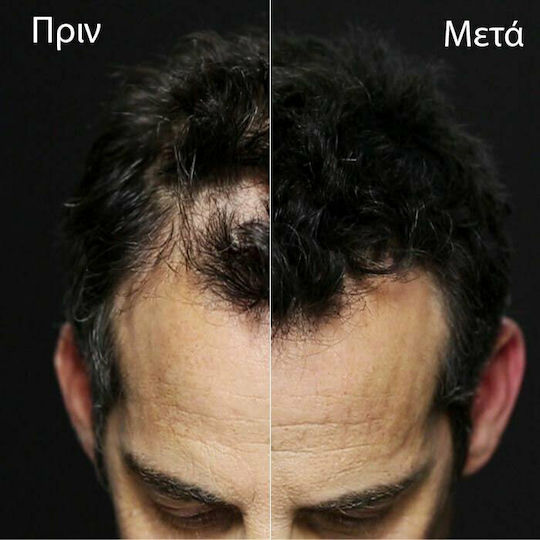 Toppik Hair Thinning Coverage Fibers with Keratin Hair Building Fibers Economy 27.5gr