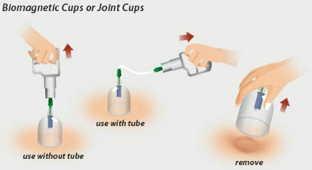 Therapeutic Device with Suction Cups Set 24pcs
