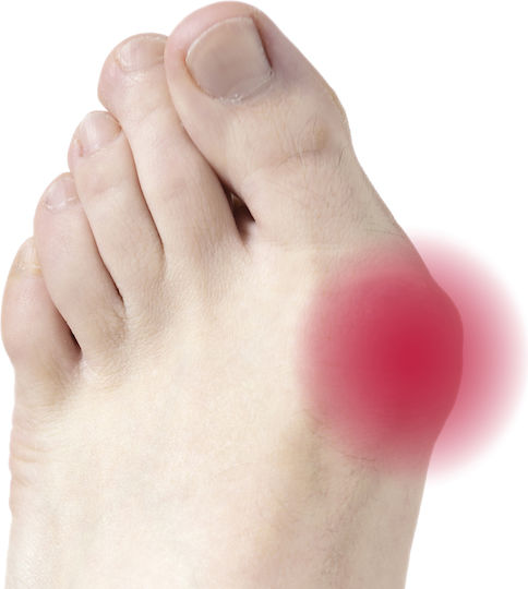 Vita Orthopaedics με Gel για τους Κάλους