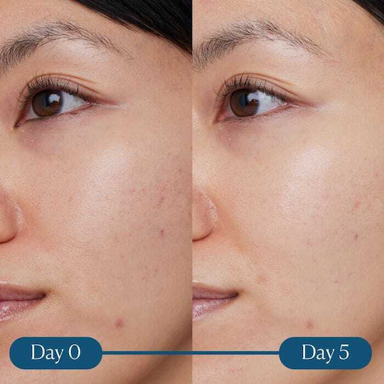 Elemis Dynamic Resurfacing Super C Serum Face with Vitamin C for Radiance 30ml