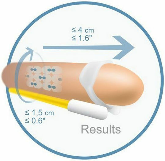 Andromedical Andromedical Androextender Penis Extender Transparent
