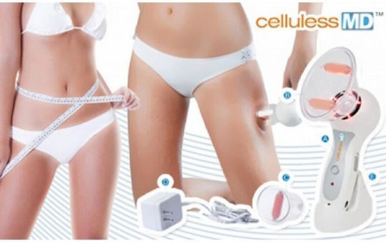 Timeless Tools Cellulite Reduction Device Massage Device for the Legs & the Body against Cellulite White