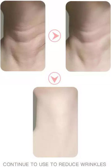 Andowl Neck Beauty Dispozitiv de terapie cu lumină Facial LED pentru Anti-Îmbătrânire Q-MJ10