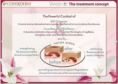 Coverderm Vanish Αnti-aging , Moisturizing & Redness Day Cream Suitable for All Skin Types 15SPF 30ml