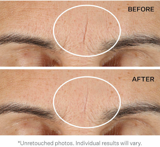 StriVectin Anti-Wrinkle LineBlueFector Primer Προσώπου σε Κρεμώδη Μορφή 30ml