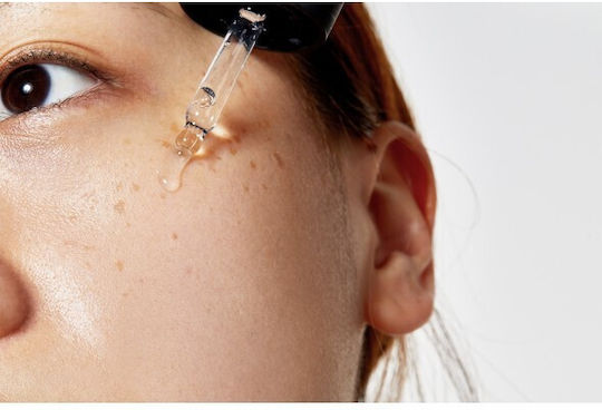 Cosrx The Niacinamide 15 Serum Προσώπου με Νιασιναμίδη για Λάμψη & Ακμή 20ml
