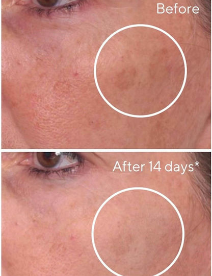 Murad Rapid Dark Spot Correcting Αντιγηραντικό Serum Προσώπου 30ml