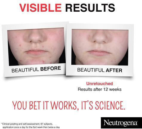 Neutrogena Clear and Defend Serum Face with Salicylic Acid for Radiance & Acne 30ml