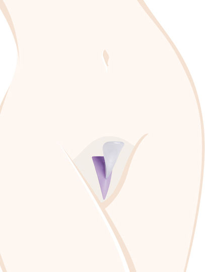 Ladyshape Bikini Shaping Tool für Frauen