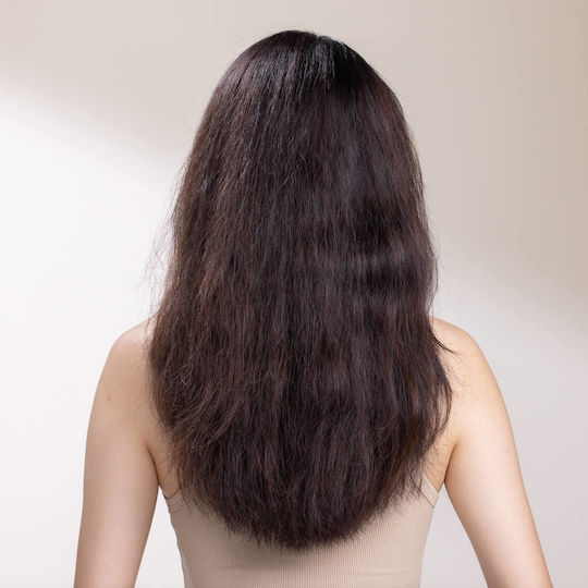 Scalp Solutions Conditioner Ενυδάτωσης & Θρέψης 200ml