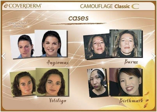 Coverderm Classic Concealing Foundation SPF30 05 15ml