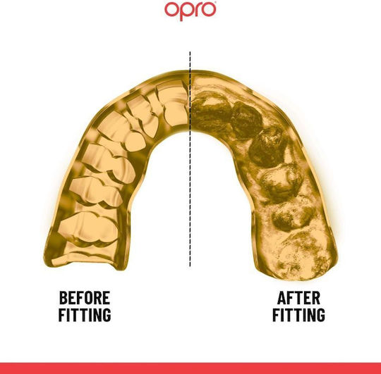 Opro Fit 102529 Protecție bucală Senior Auriu