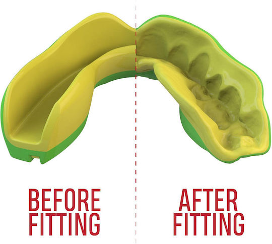 Safejawz Junior Protective Mouth Guard Green