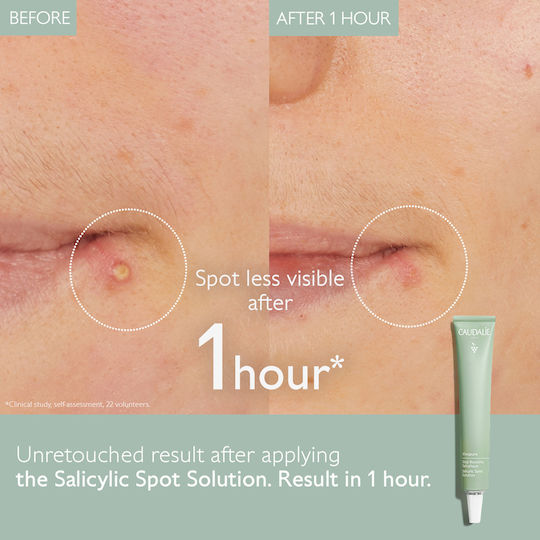 Caudalie Vinopure Stop Boutons Κρέμα Προσώπου κατά της Ακμής & της Ερυθρότητας με Νιασιναμίδη 15ml