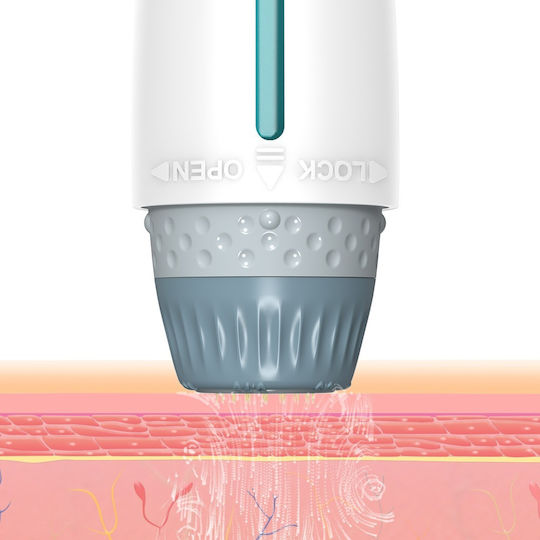 Dr. Pen Συσκευή Microneedling για Αντιγήρανση 03578