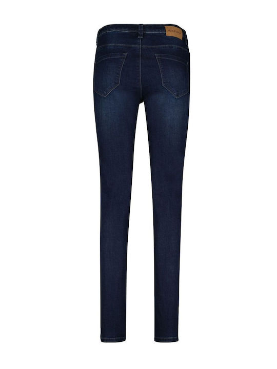 Γυναικείο Jean Παντελόνι σε Skinny Εφαρμογή