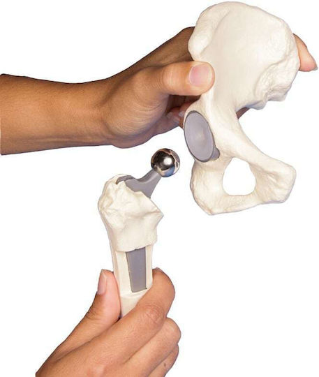 Erler Zimmer Πρόπλασμα Appendages & Joints