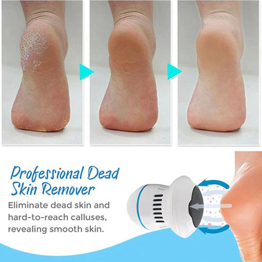 Rechargeable Electric Foot File for Heels & Calluses