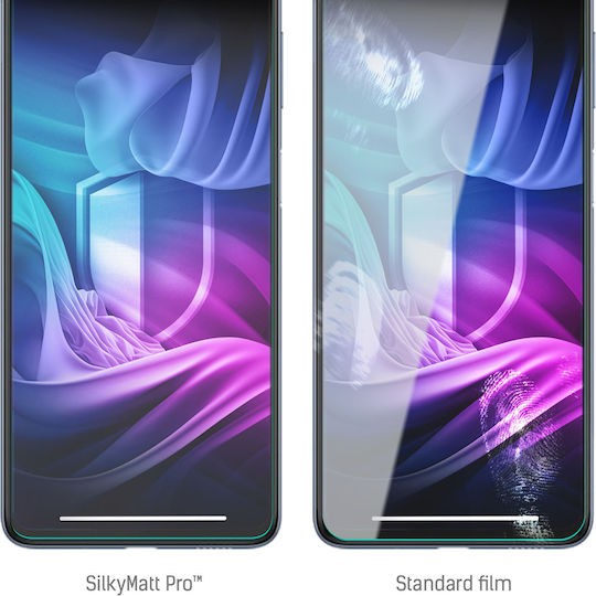 3MK Silky Matt Pro Screen Protector (Honor X6A)