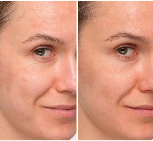 it Cosmetics Creme de fata pentru Reconstrucție & Imperfecțiuni cu Peptide 120ml