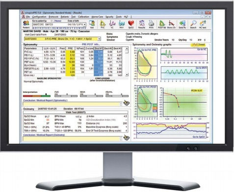 MIR Spirometru New Spirolab