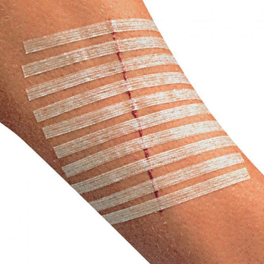 Sterile Adhesive Patches - Stitching 4x76mm (8 strips)