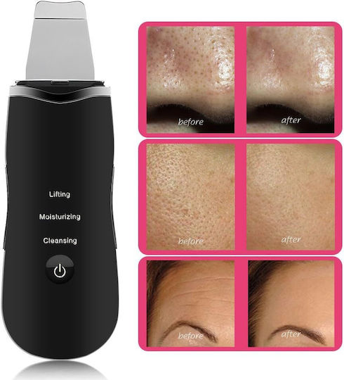 Exfoliant ultrasonic Ubx încărcare USB negru 2 capete de silicon 17.5x5.5x1.5 cm
