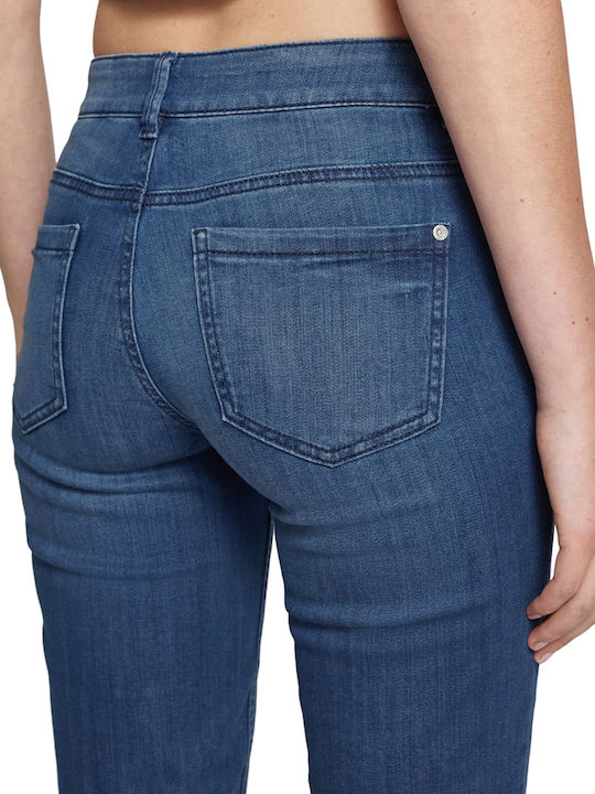 Γυναικεία Βερμούδα Mid Stone Wash Denim