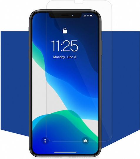 3MK 0.16mm Keramik Gehärtetes Glas (Lenovo Tab M9)
