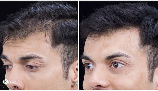 Kmax Milano Hair Building Fibers with Keratin 5gr