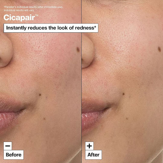 Dr. Jart+ Cicapair Intesive Ενυδατική Κρέμα Προσώπου κατά της Ερυθρότητας με Νιασιναμίδη & Centella Asiatica 50ml