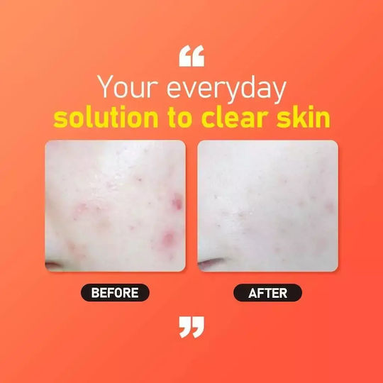 Jumiso All Day Vitamin Moisturizing Serum Face with Vitamin C & Hyaluronic Acid for Detoxification & Radiance 30ml