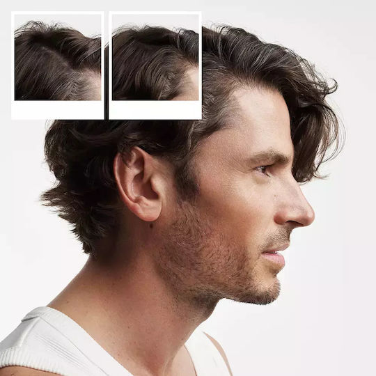 Nioxin System 2 Haarkur-Set mit Shampoo, Conditioner und Behandlung 3Stück