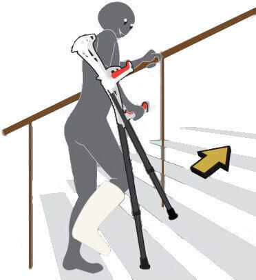 FDI Forearm Crutches FDI Forearm Crutches Achselkrücken Weiß 86064