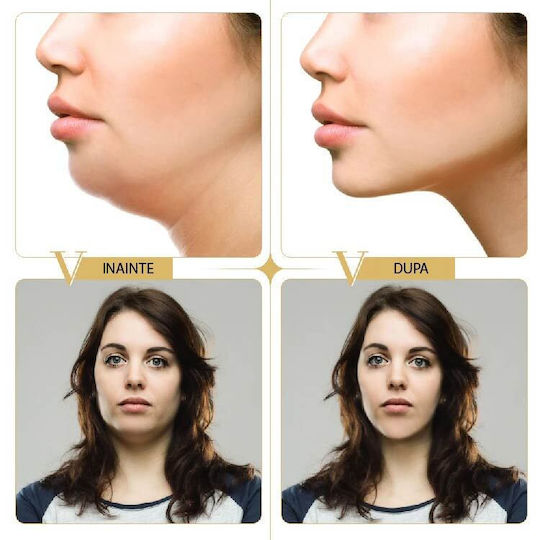 Set de Măști Lifting Facial în Formă de V, 5 Bucăți