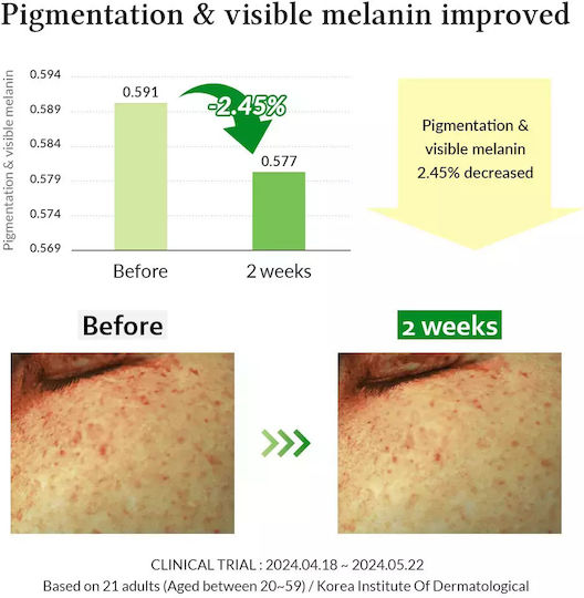 Dr. Althea Καταπραϋντικό & Αντιγηραντικό Serum Προσώπου με Βιταμίνη C & Νιασιναμίδη για Λάμψη & Πανάδες 30ml