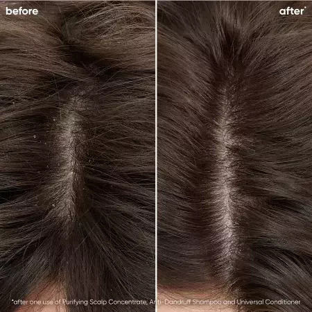 Шампоан против пърхот за суха коса Lakme K.therapy Peeling Dry Shampoo 1000ml