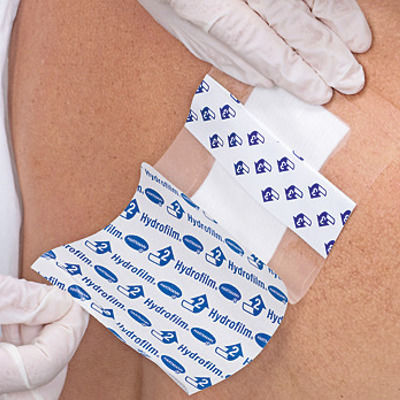 Hartmann Hydrofilm Waterproof & Sterilized Plasters 9x15cm 5pcs