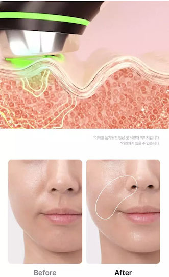 Medicube AGE-R Booster Pro Αnti-ageing / Firming / Pore Tightening Light Therapy Device Face LED Black
