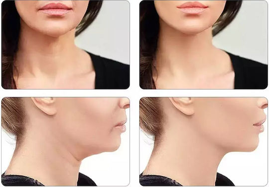 Paloma Beauties Face Light Therapy Device
